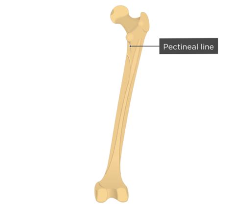 pectineal line